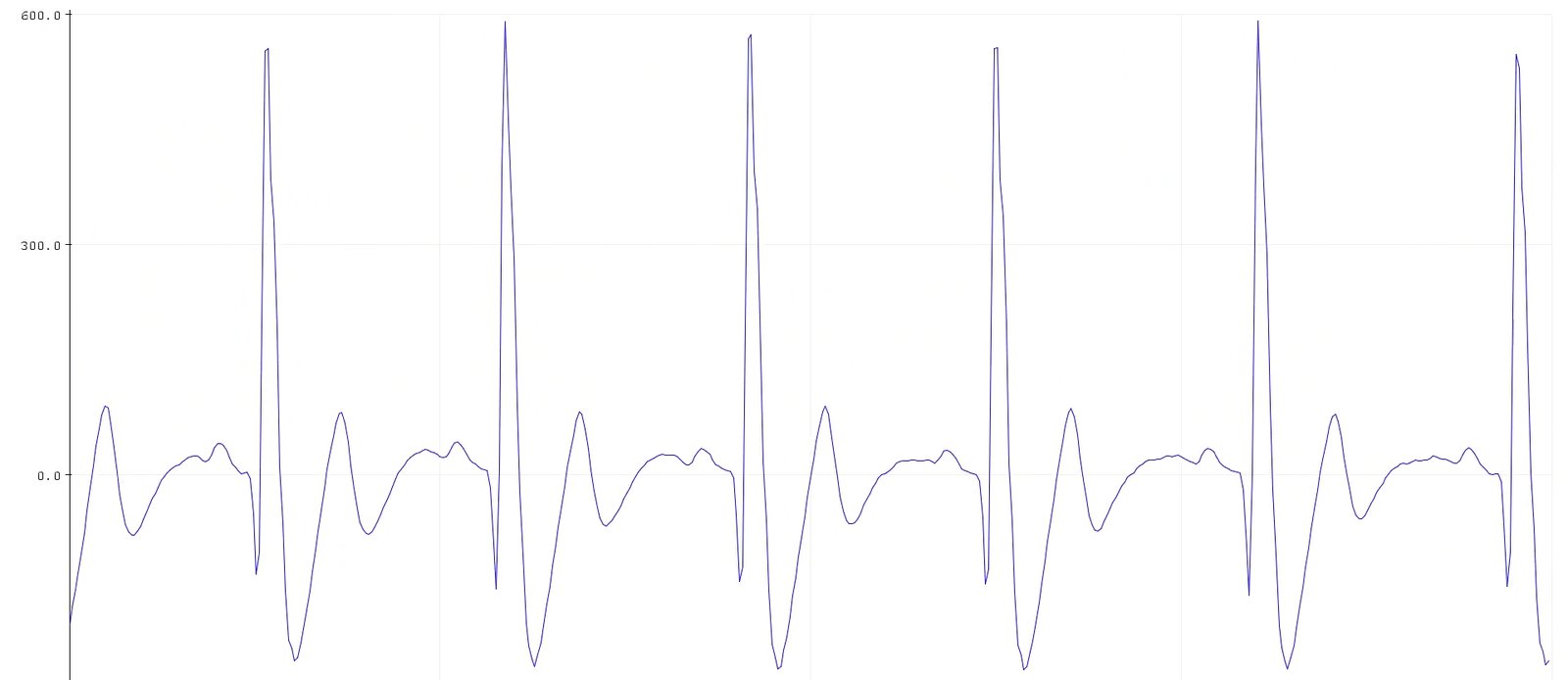Memvisualisasikan sinyal ECG di Arduino IDE v1.8.x