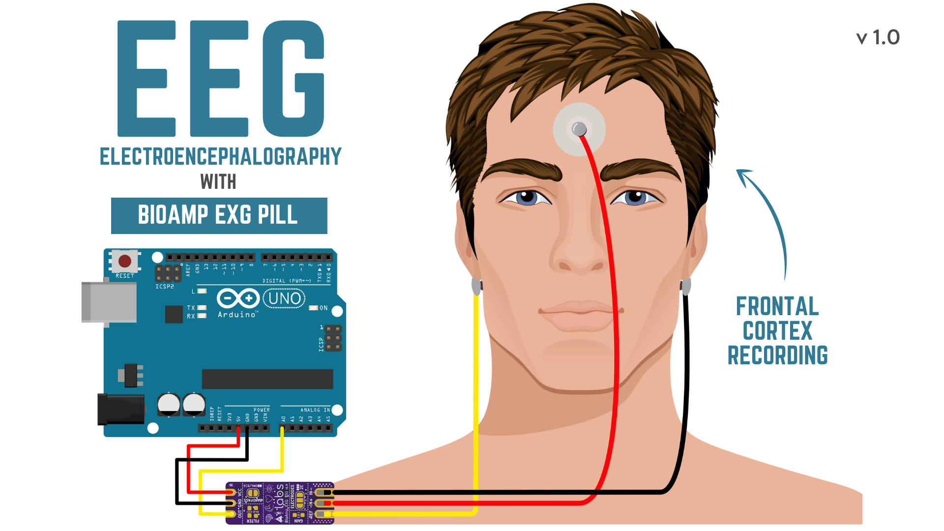 ../../../_images/eeg_placement.png